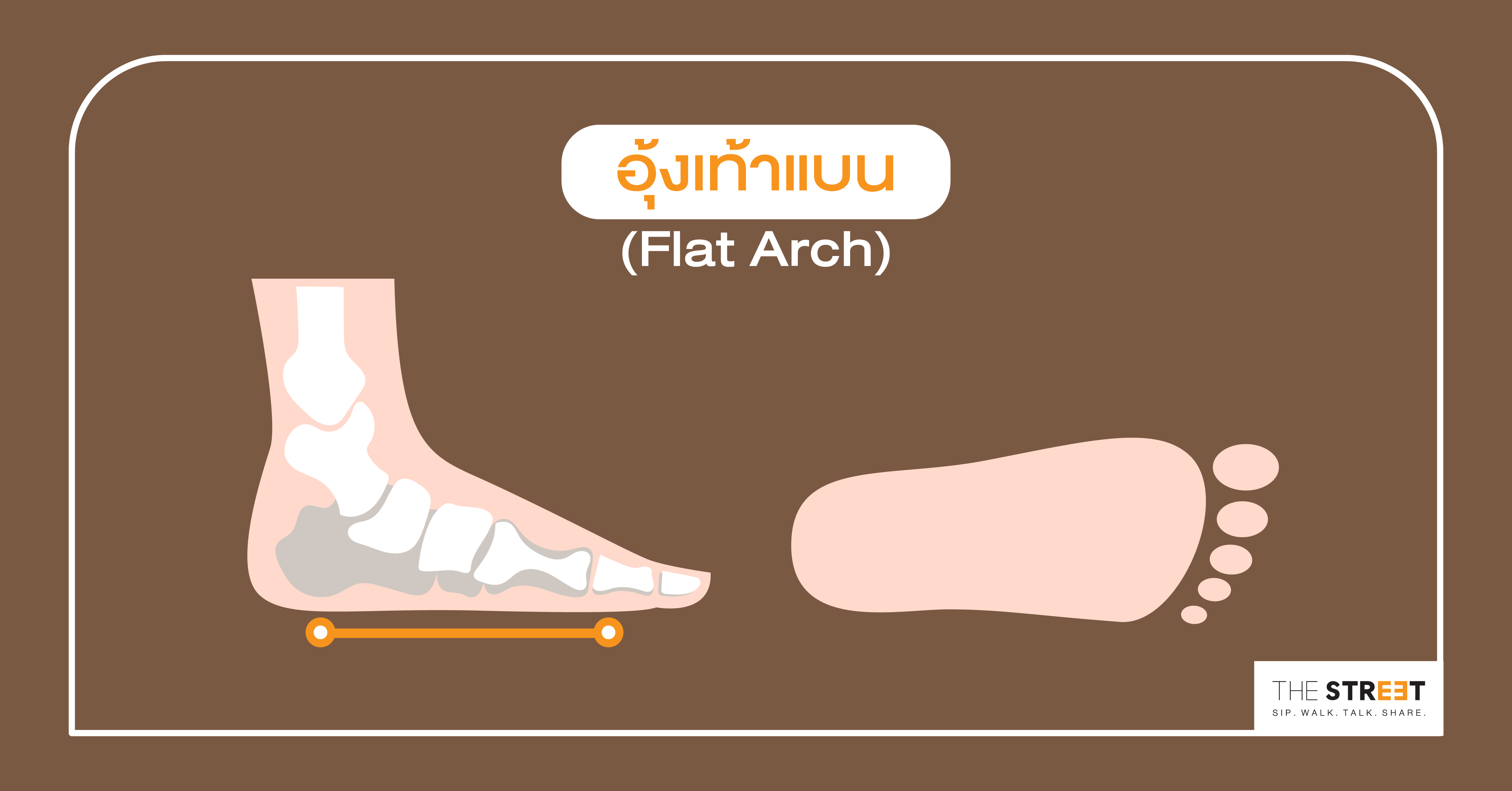 วิธีเลือกรองเท้าวิ่งสำหรับคนเท้าแบน (Flat Arch)